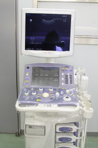 超音波断層診断装置(エコー)